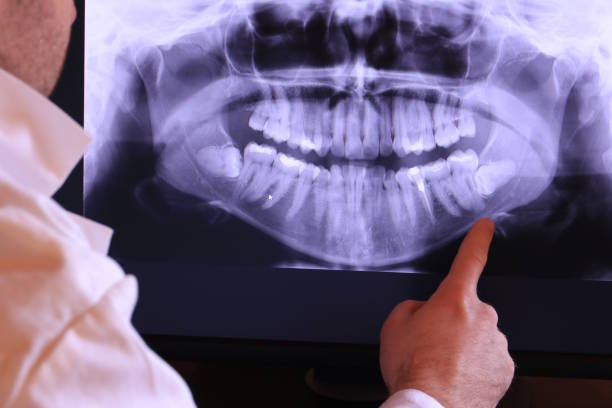 Best Emergency Broken Tooth Repair in Atlantic City, NJ