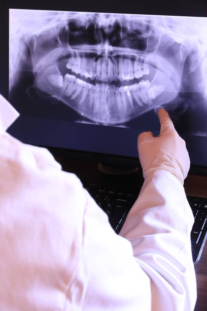 Best Emergency Tooth Extraction in Atlantic City, NJ